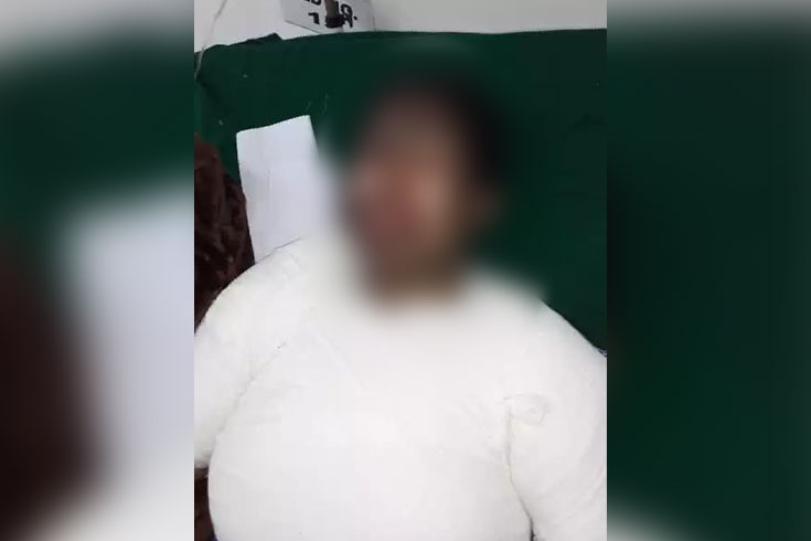 সাবেক-স্বামীর-অ্যাসিডে-দগ্ধ-তরুণী