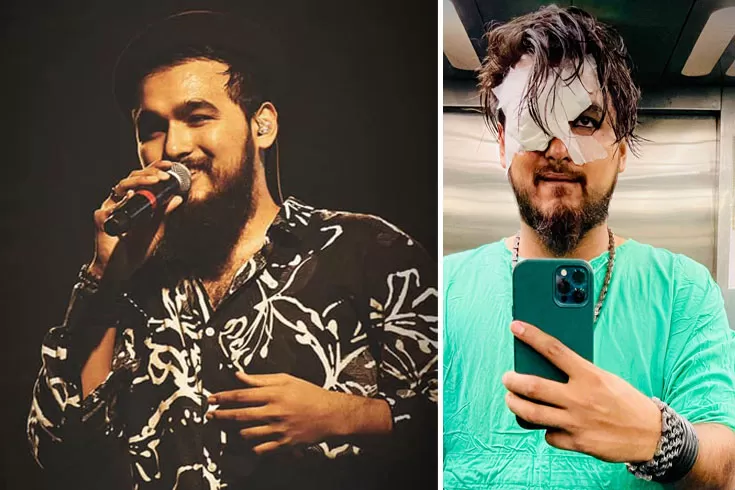 দুর্ঘটনায়-নোবেল-পড়েছে-৩০-সেলাই
