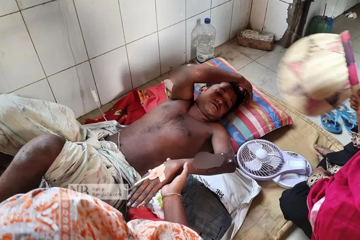 কারখানায়-বয়লার-দুর্ঘটনা-২-শ্রমিক-দগ্ধ