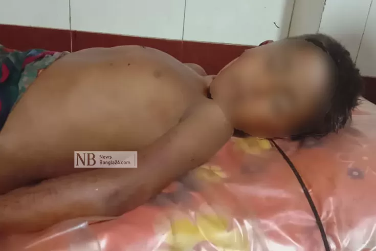 অটোরিকশাচাপায়-প্রাণ-গেল-শিশুর