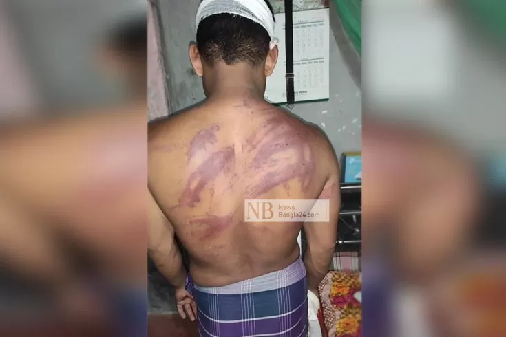 ভোট-না-দেয়ায়-পিটিয়ে-জখম