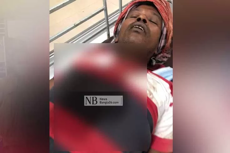 হামলায়-কাদের-মির্জার-৪-অনুসারী-আহত