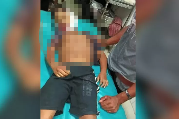 কালকিনিতে বাইকচাপায় শিশুর মৃত্যু, আটক তরুণ