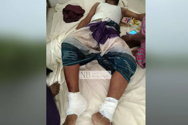 পিটিয়ে জখমের পর পায়ের ‘রগ কর্তন’