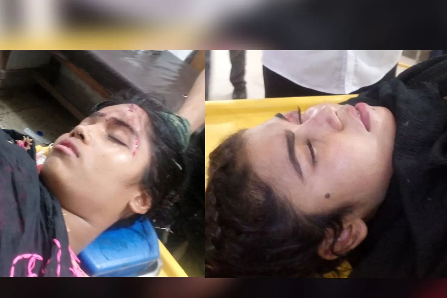 বাসের সংঘর্ষে আহত দুই কাবাডি খেলোয়াড়