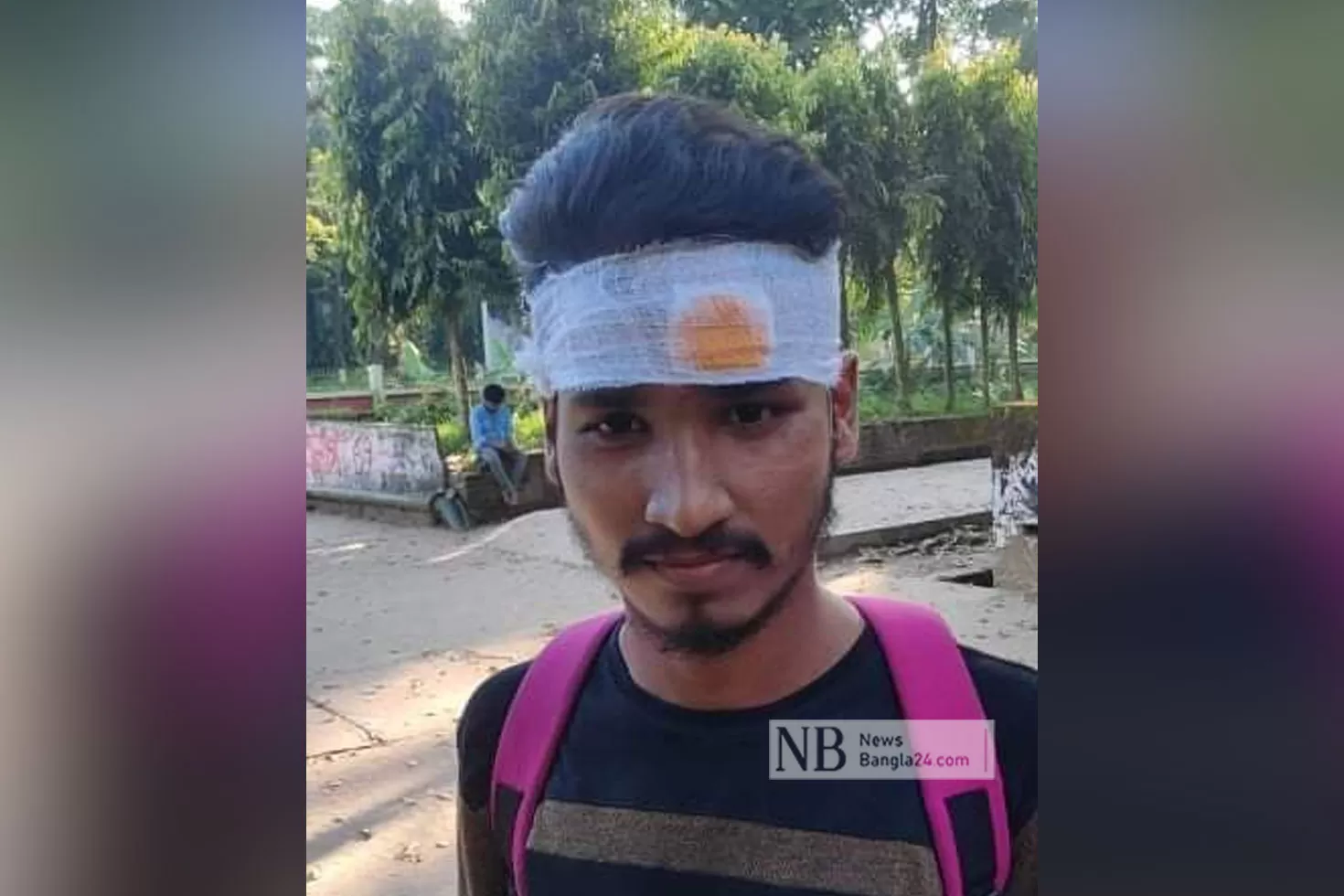 চবিতে ভর্তিচ্ছুর মাথা ফাটাল ছাত্রলীগকর্মীরা
