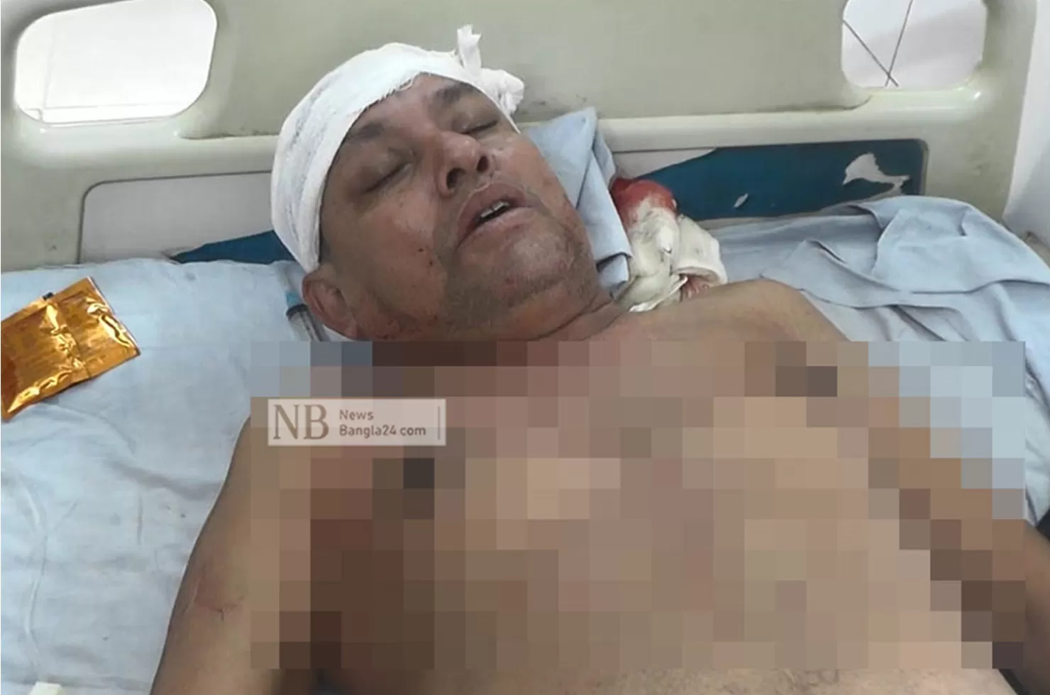 সাতক্ষীরায় সংঘর্ষে নৌকার প্রার্থীসহ আহত ১০