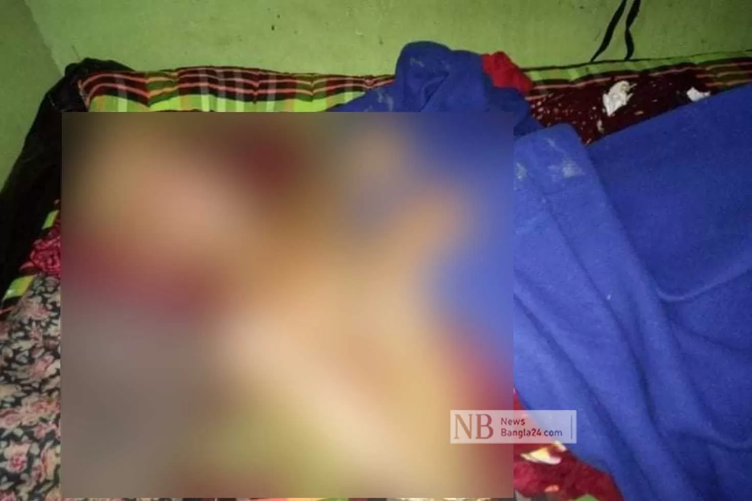 ‘গরম তেলে স্বামীকে ঝলসে ৯ দিন আটকে রাখেন স্ত্রী’ 