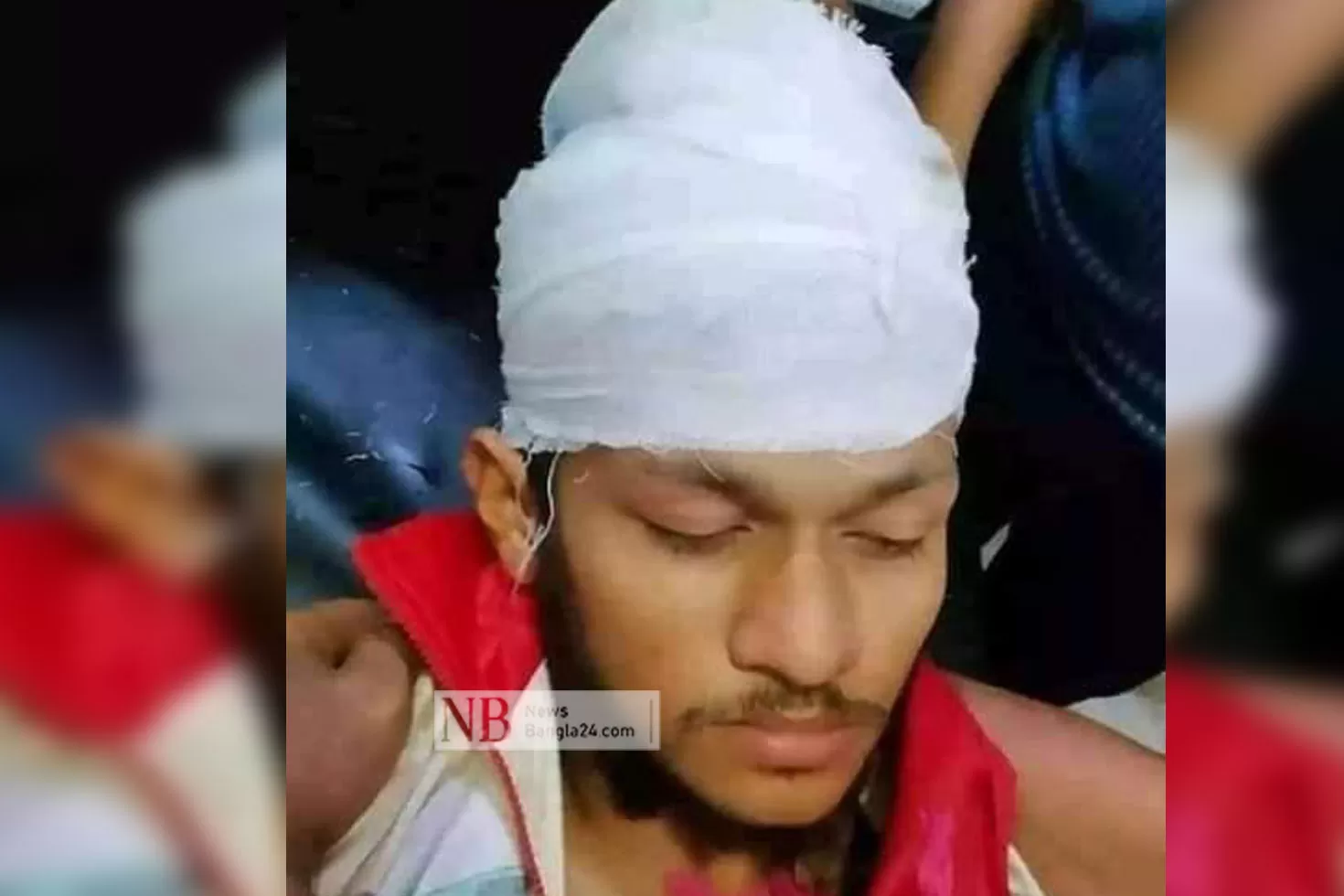 ভোটের সহিংসতায় আহত যুবকের মৃত্যু
