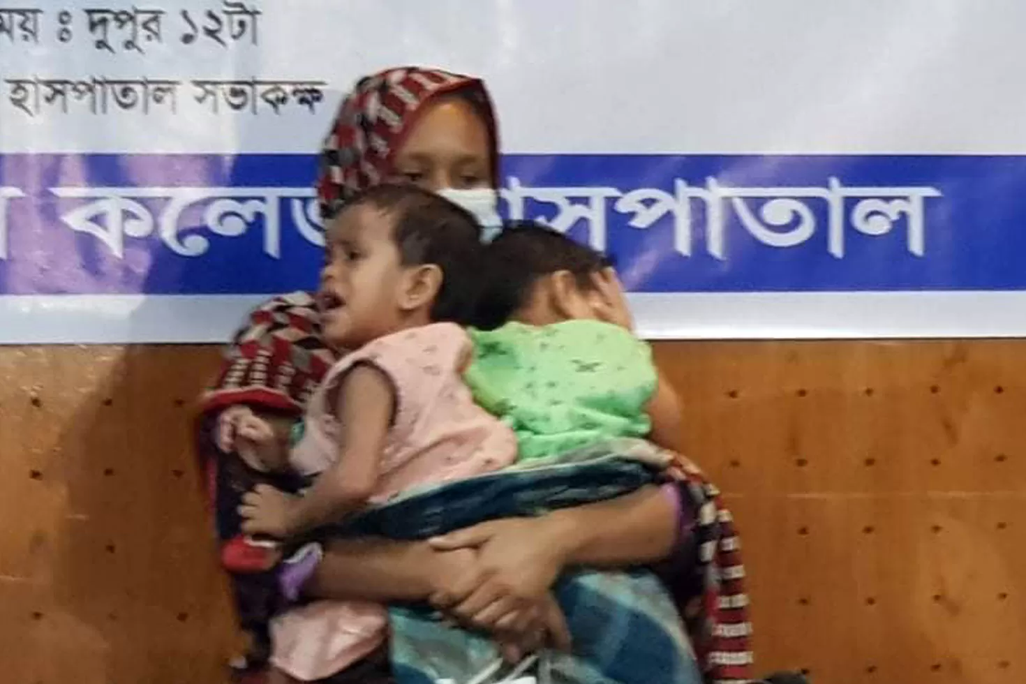 লাবিবা-লামিসাকে-আলাদা-করতে-চলছে-অস্ত্রোপচার