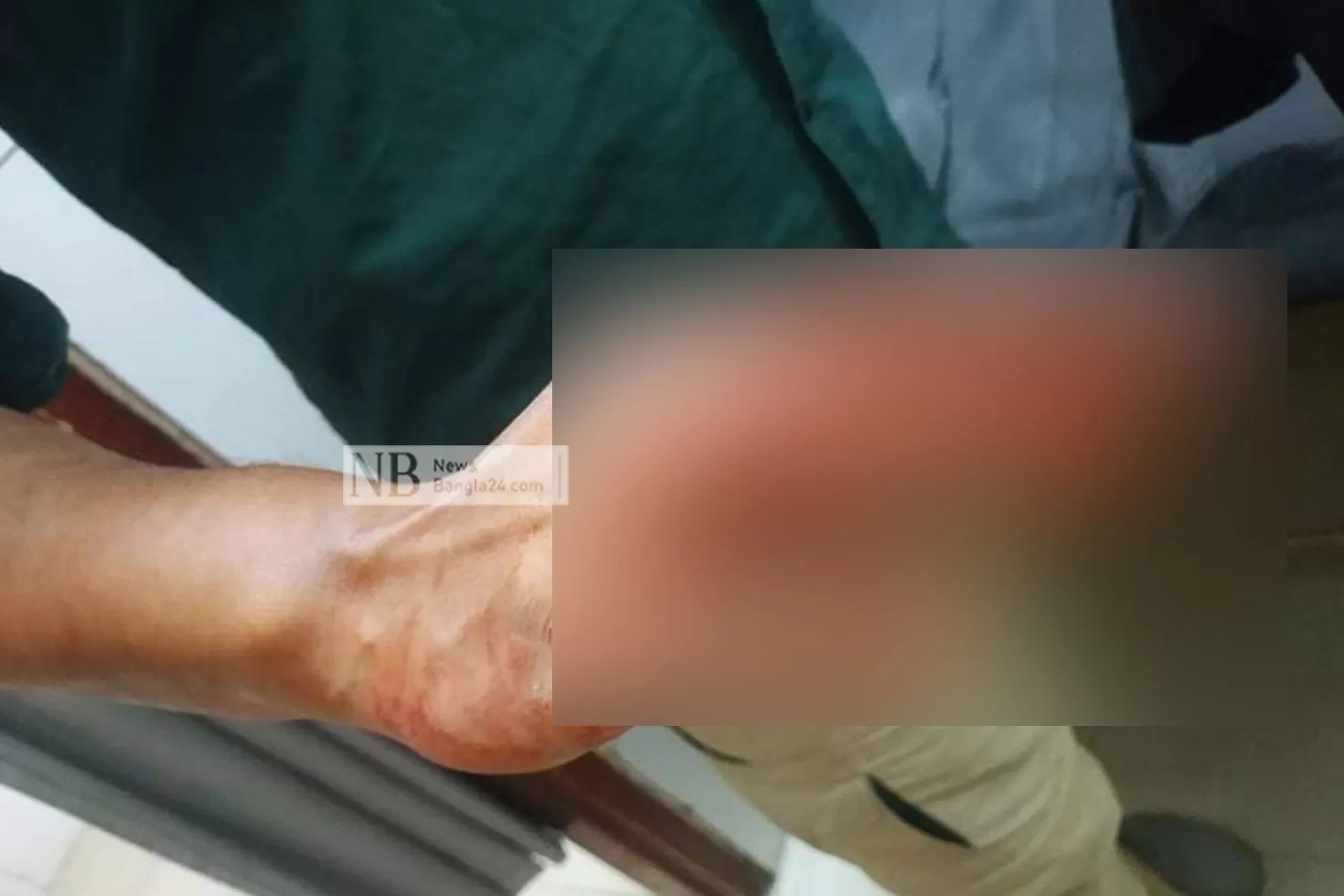 বাস-ভাড়া-নিয়ে-তর্ক-চবির-২-শিক্ষার্থীকে-ধাক্কা