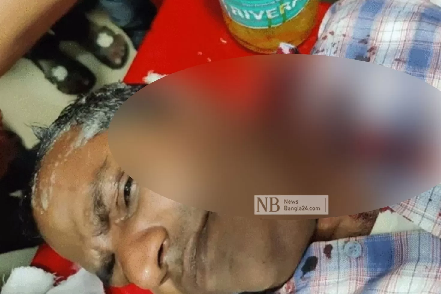 প্রতিপক্ষের-হামলায়-জেলা-বিএনপি-নেতা-আহত