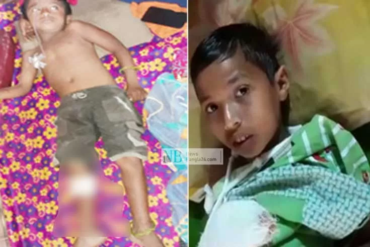 বল ভেবে বোমা হাতে, বিস্ফোরণে আহত ২ শিশু