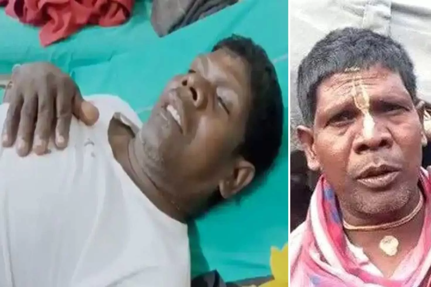 দুর্ঘটনার-আহত-কাঁচা-বাদাম-গানের-শিল্পী