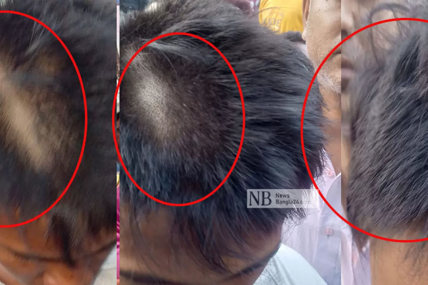 পুলিশের-বিরুদ্ধে-২-স্কুলছাত্রের-চুল-কাটার-অভিযোগ