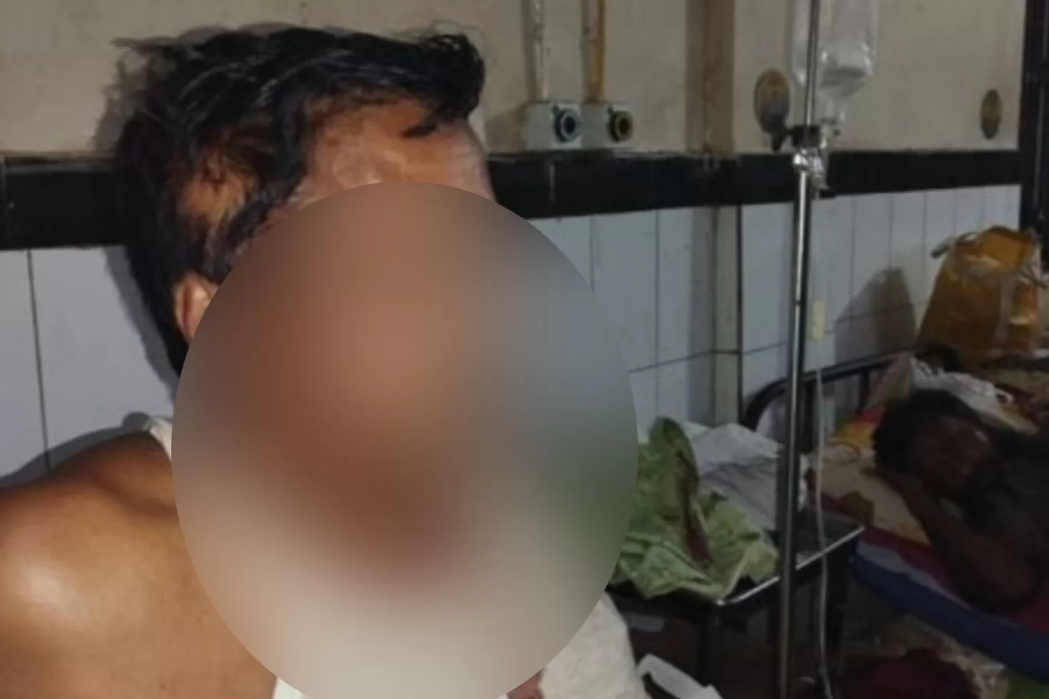 আইনজীবী সহকারীর মাথা ফাটাল ‘আসামি’