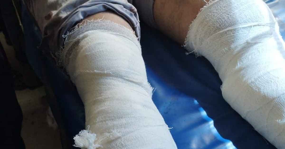 কাশিয়ানীতে সন্ত্রাসী হামলায় যুবক জখম