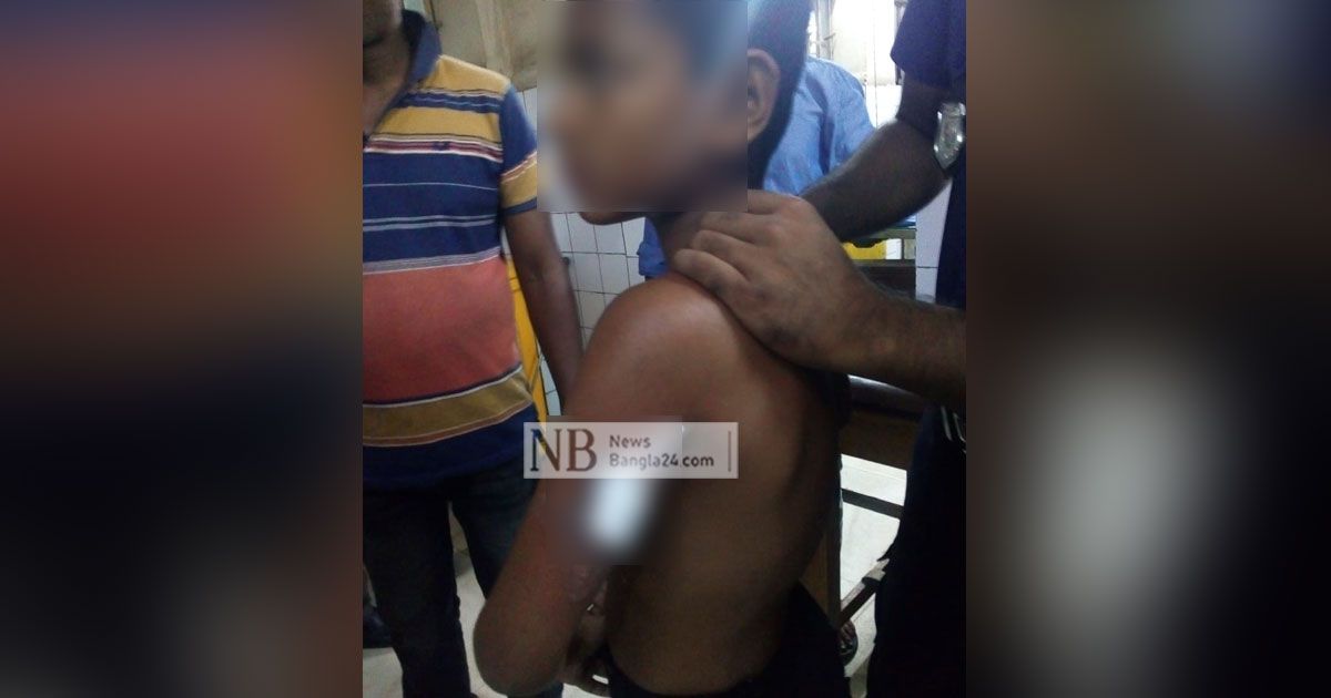 ‘ধাক্কা লাগায়’ গরম তেলে শিশুর হাত ঝলসে দিলেন বাবুর্চি