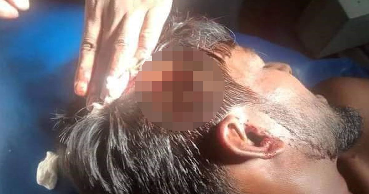 নির্বাচনি প্রচারকালে সহিংসতায় আহত ১২ 