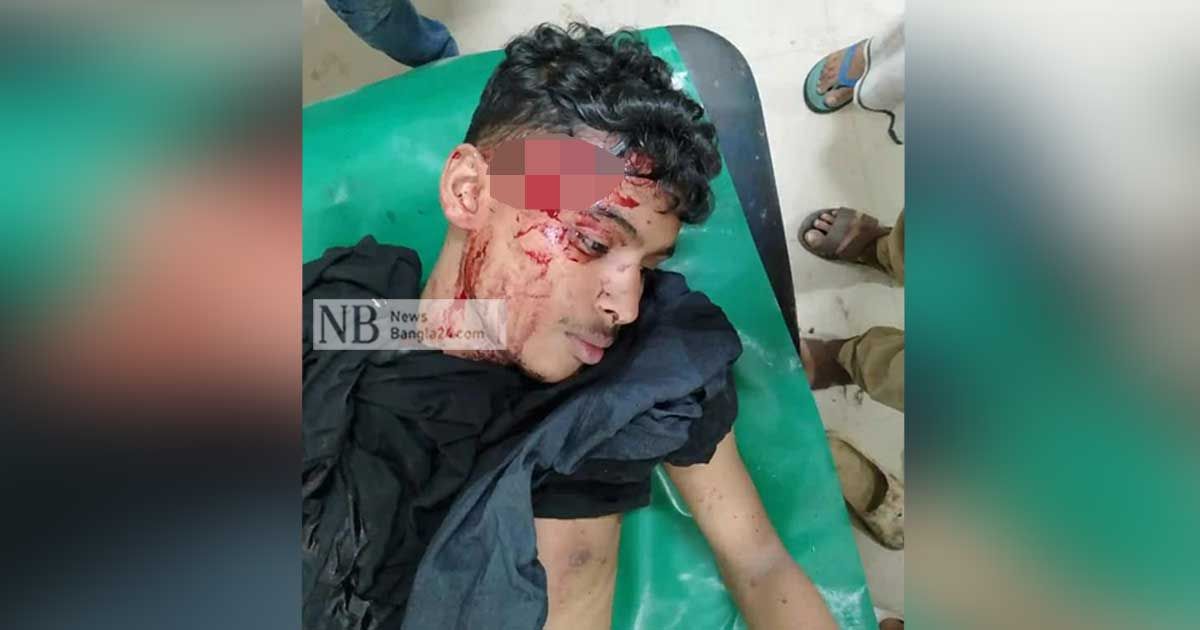 দুই কাউন্সিলর প্রার্থীর সমর্থকদের মধ্যে ধাওয়া-পাল্টাধাওয়া
