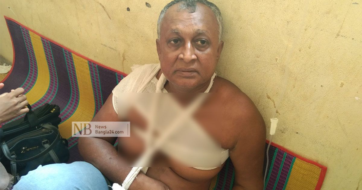 পিঠে ছুরিবিদ্ধ, নিজেই গাড়ি ভাড়া করে গেলেন হাসপাতালে