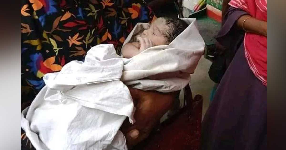 How-the-baby-was-born-after-the-stomach-burst-after-being-hit-by-a-truck