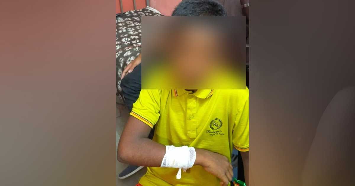 শিশুকে-সিগারেটের-ছ্যাঁকা-১-হাজার-টাকায়-রফা