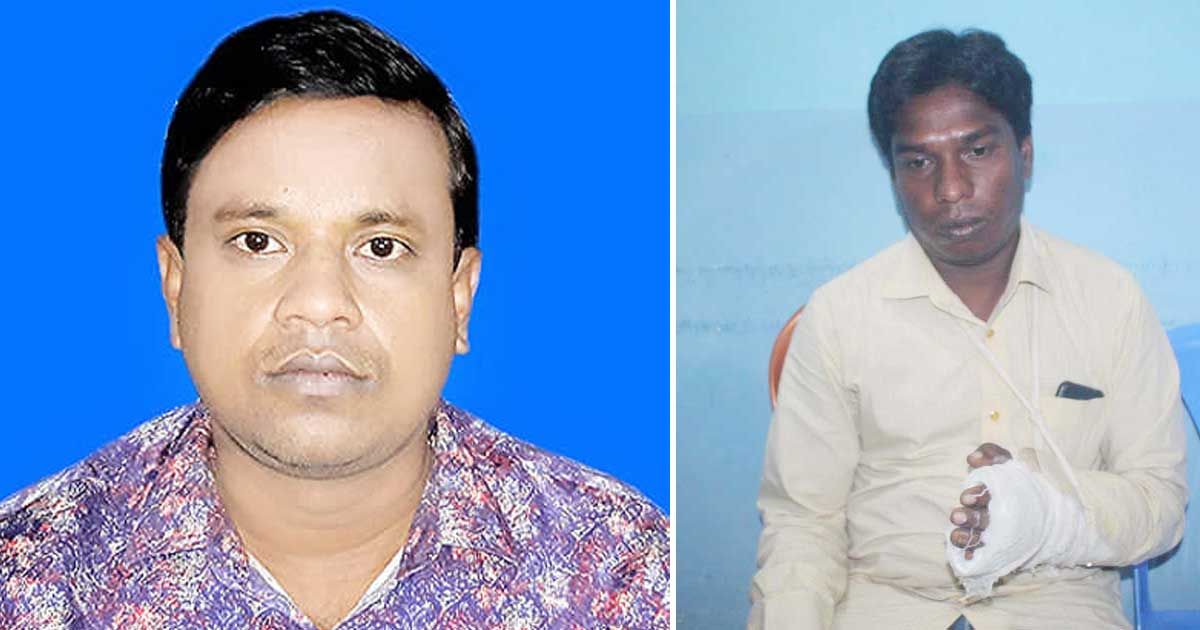 বিপক্ষে ভোট করায় হাত ভেঙে দিলেন ‘চেয়ারম্যান’