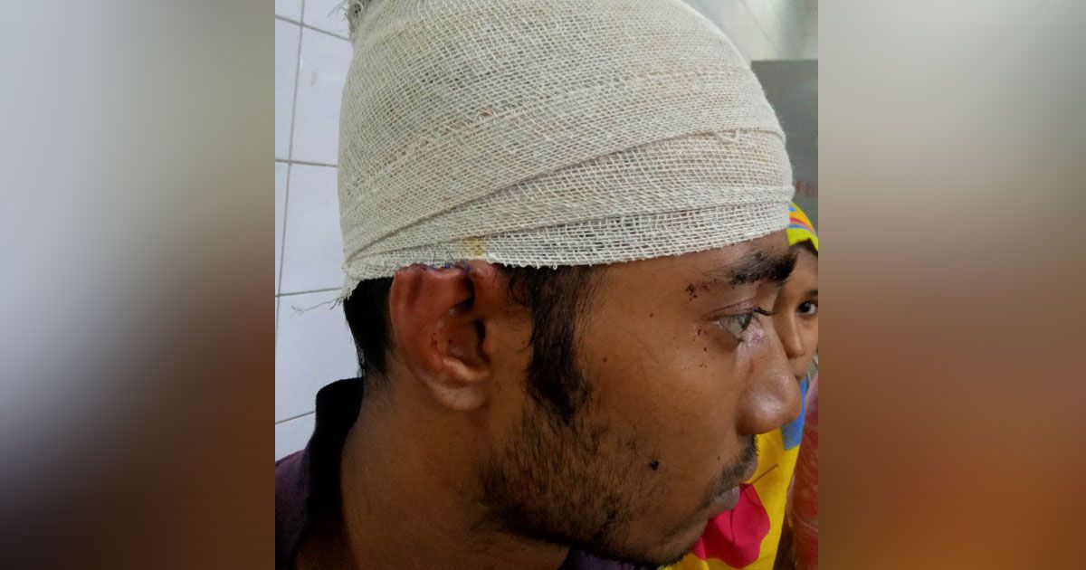 গাঁজা বিক্রিতে প্রতিবাদ, কানের একাংশ হারাল যুবক