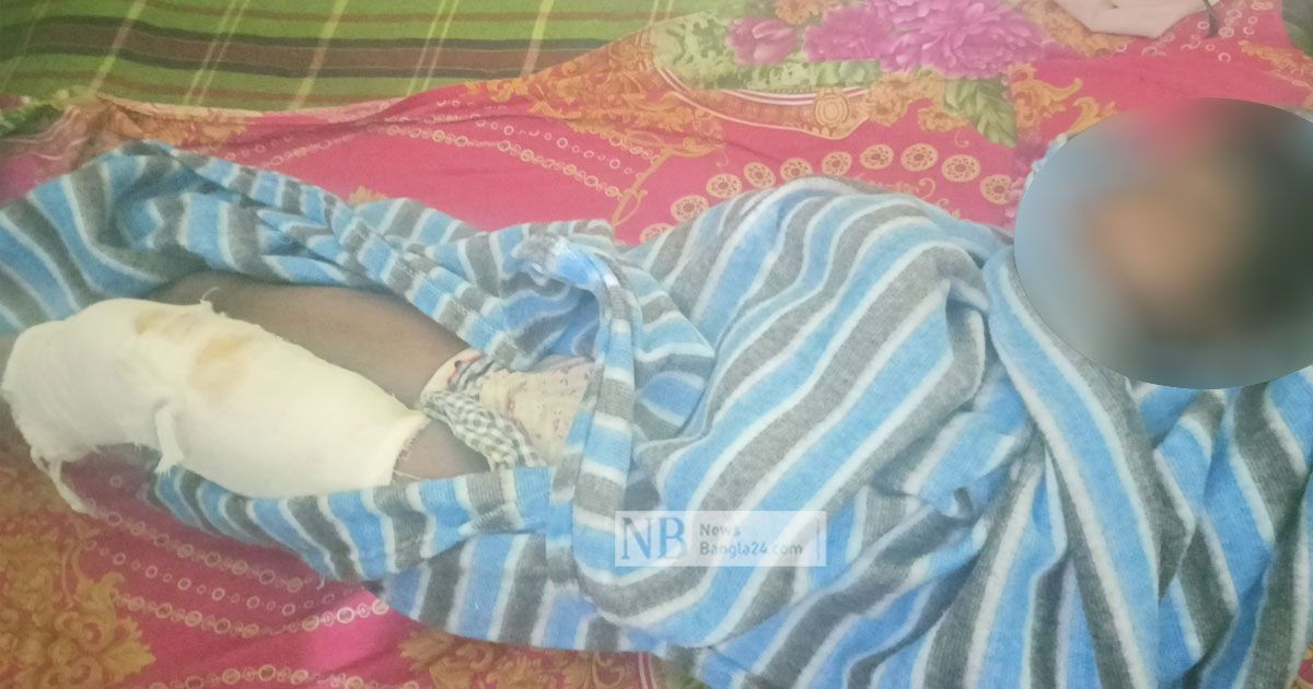শিশু গৃহকর্মীর পায়ে গরম পানি ঢালার অভিযোগ, গৃহকর্ত্রী আটক
