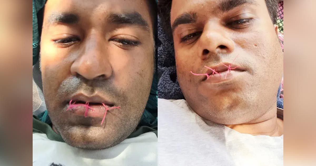 মুখ-সেলাই-করে-প্রতিবাদ-নাউরুতে-আটকা-দুই-বাংলাদেশির