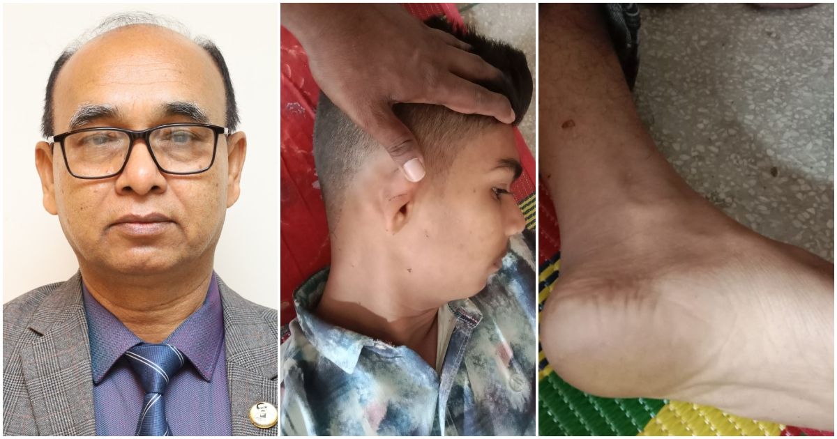 দুই-শিশুকে-কৃষির-ডিজি-ও-পরিবারের-অমানুষিক-নির্যাতন