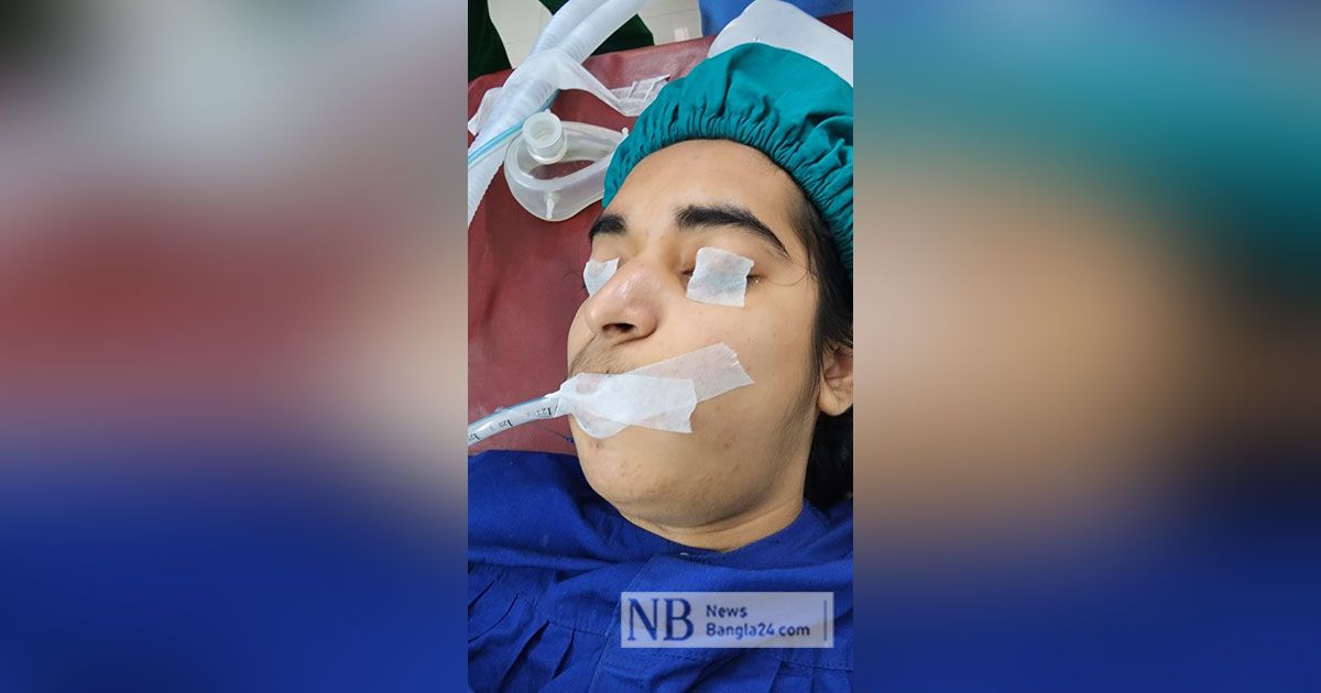 Conversion-of-boy-to-girl-through-surgery-in-Khulna