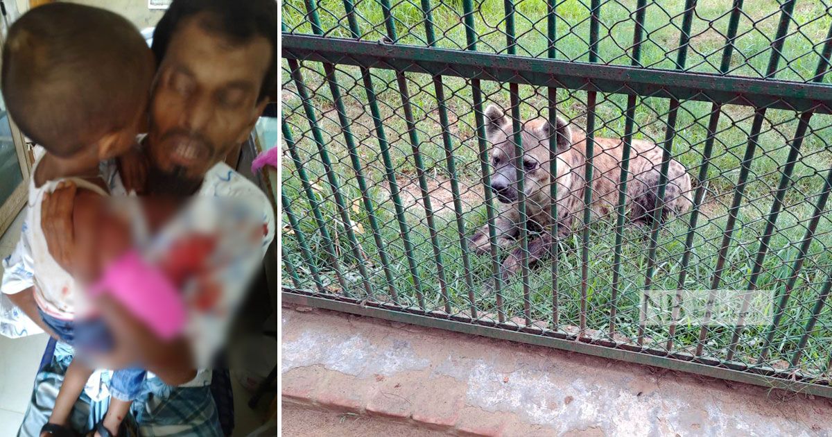 A-hyena-has-bitten-off-a-childs-hand-at-the-zoo