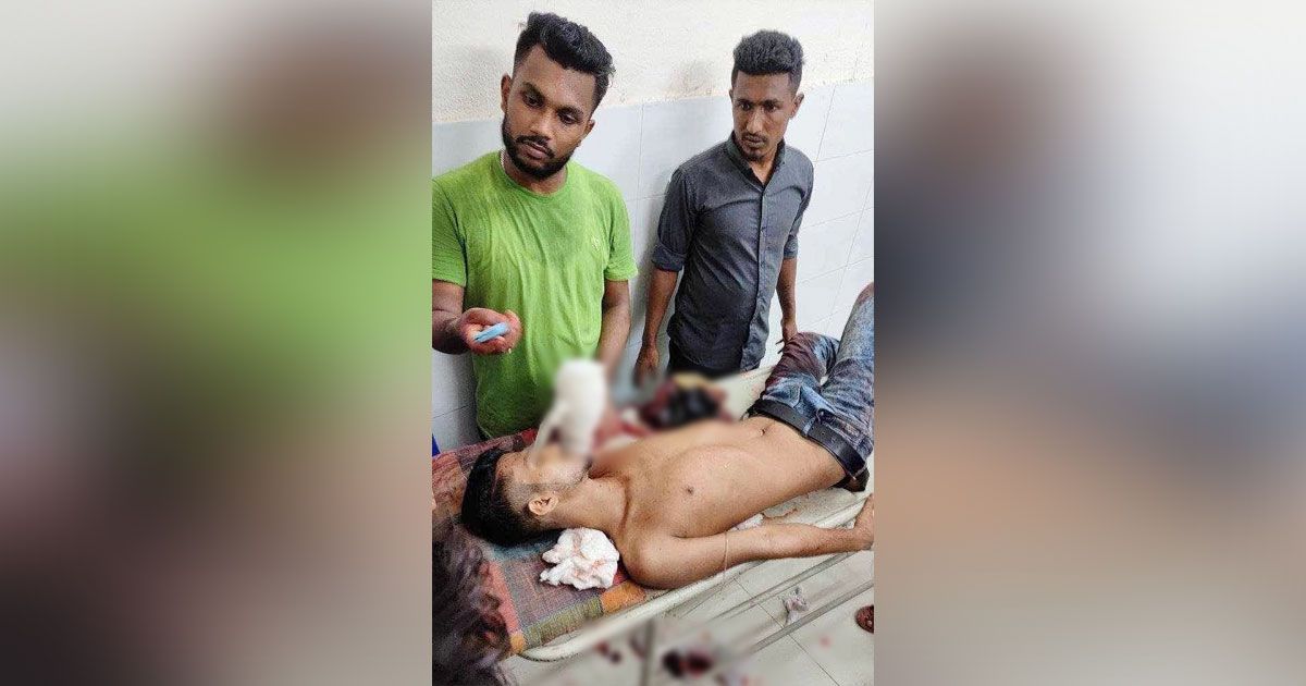 প্রতিপক্ষের-রামদার-কোপে-ছাত্রলীগ-কর্মীর-হাত-বিচ্ছিন্ন