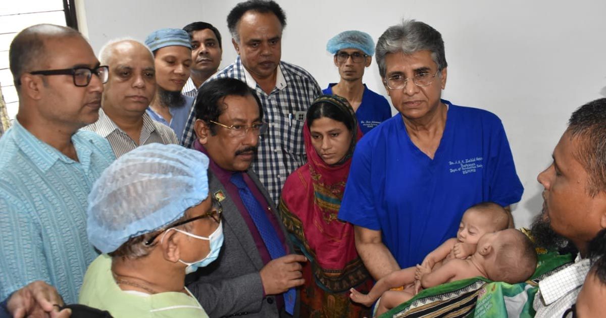 বিএসএমএমইউতে-আলাদা-হলো-জোড়া-লাগানো-দুই-শিশু