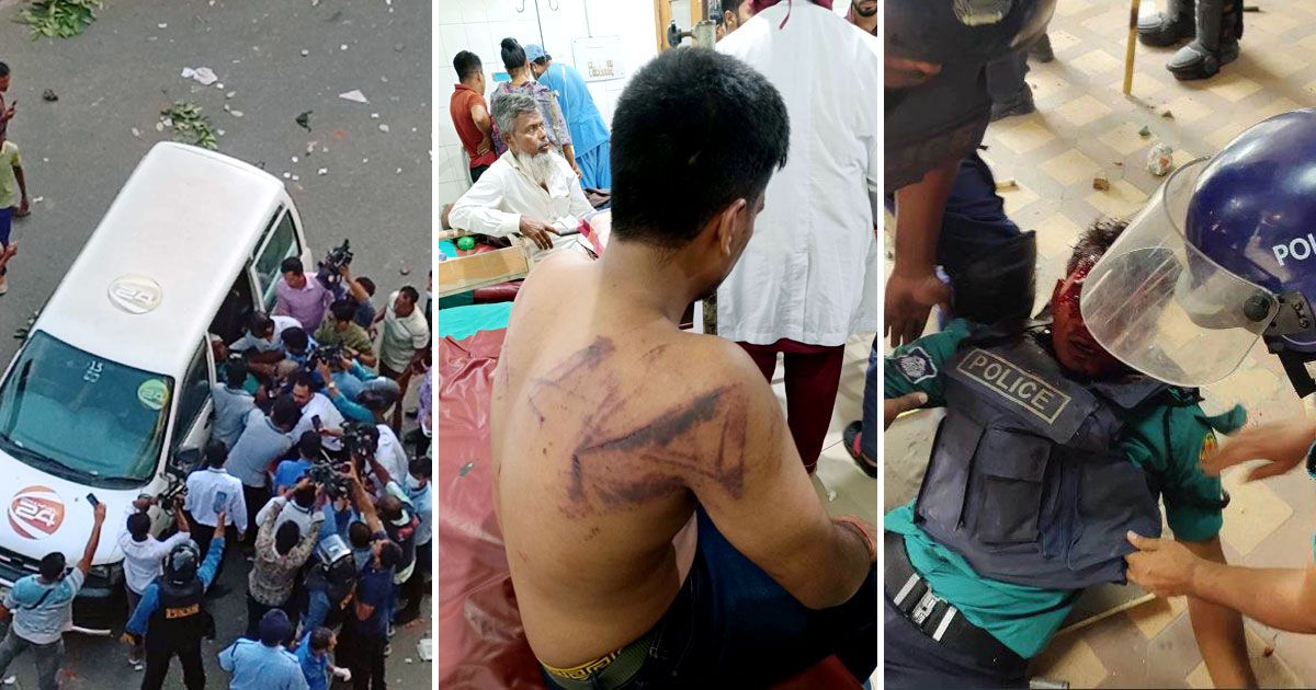 ৫-সাংবাদিক-ও-১৯-পুলিশসহ-ঢাকা-মেডিক্যালে-৫০