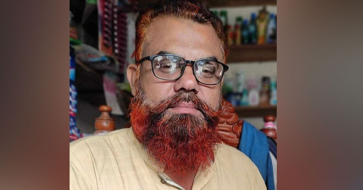 নাটোরে-ডিবি-পরিচয়ে-তুলে-নিয়ে-যুবদল-নেতাকে-কুপিয়ে-জখম