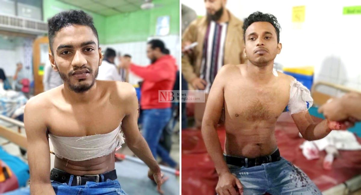 নৌকার-প্রচারে-গিয়ে-কামরাঙ্গীরচরে-দুই-যুবক-ছুরিকাঘাতে-আহত