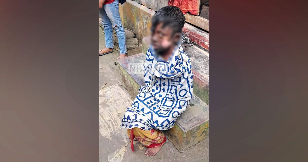 মায়ের-অন্যত্র-বিয়ে-শিশুপুত্রকে-পুড়িয়ে-হত্যাচেষ্টা-বাবার