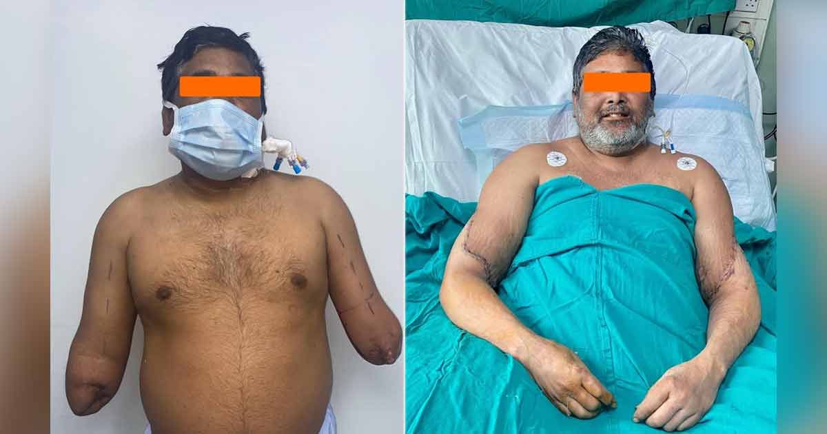 নারীর-দান-করা-দুই-হাত-জোড়া-লাগল-পুরুষের-শরীরে
