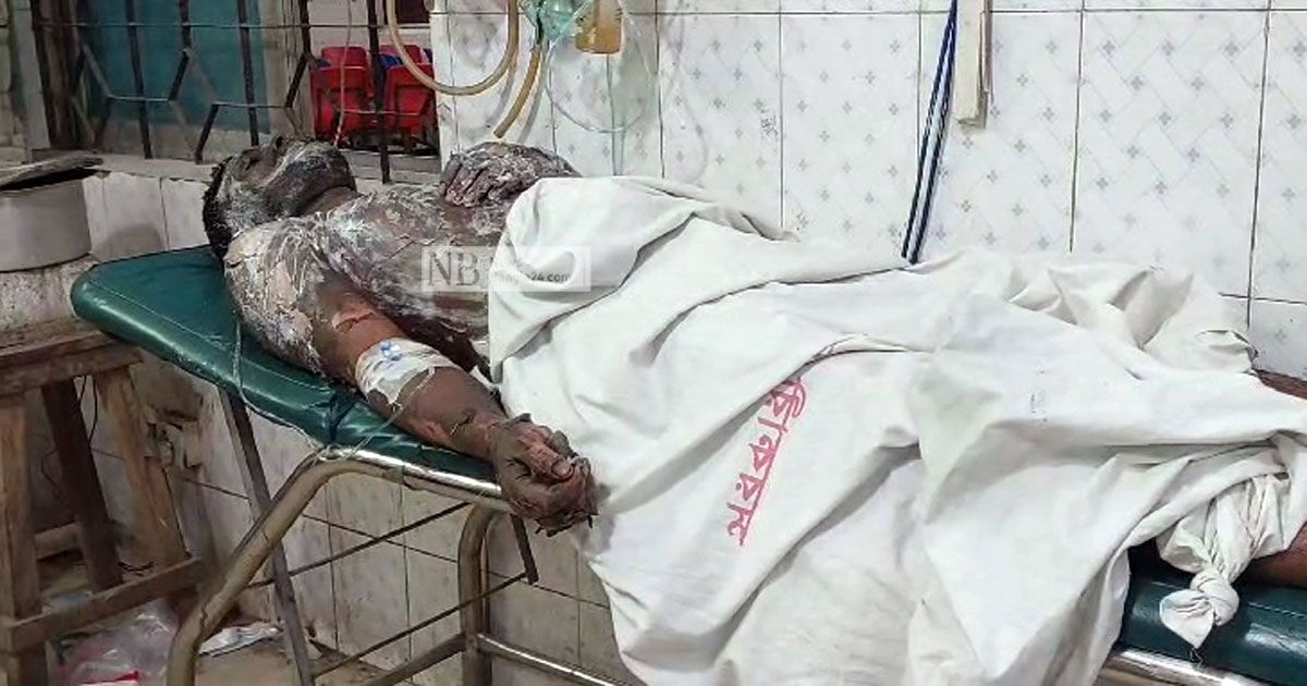 মুন্সীগঞ্জে প্লাস্টিক মিলে আগুন, দগ্ধ চার