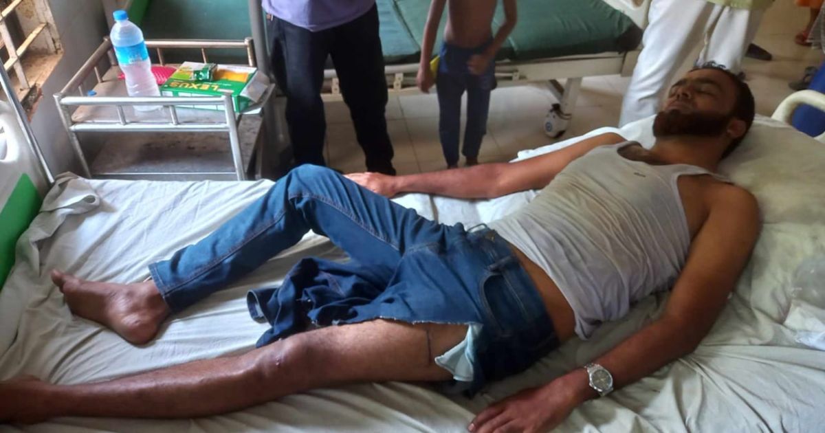 Reporter-of-fake-milk-production-in-Pabna-allegedly-beaten-and-broken-leg