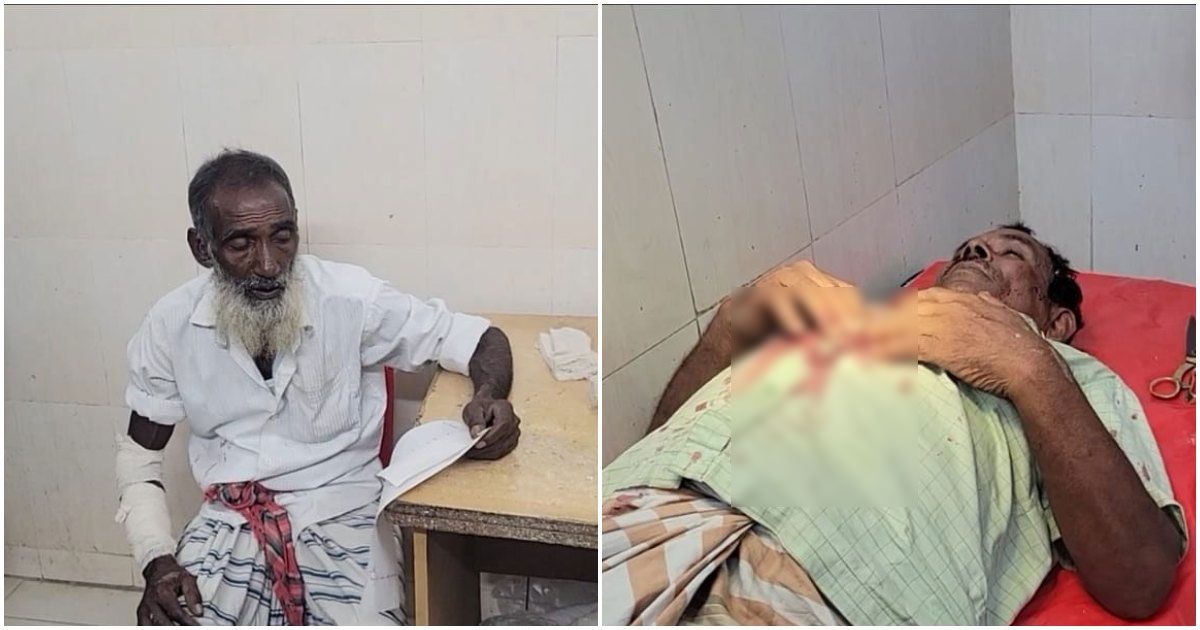 আটঘরিয়ায় দুই চেয়ারম্যান প্রার্থীর সমর্থকদের পাল্টাপাল্টি হামলার অভিযোগ, আহত ১০