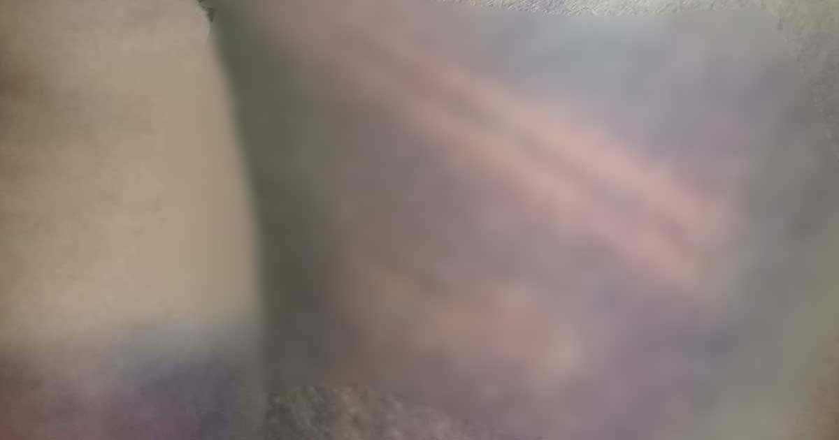 ক্লাসে-না-আসায়-শিক্ষার্থীকে-পিটিয়ে-জখমের-অভিযোগ
