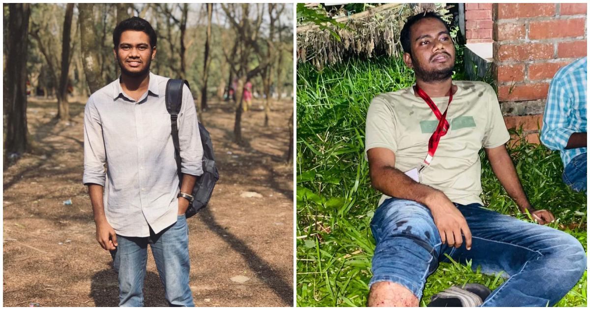 পুলিশের গুলিতে আহত নিউজবাংলার জাবি প্রতিনিধি সার্জিল