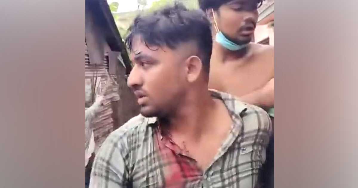কোটার-আন্দোলনকালে-ববি-শিক্ষার্থী-গুলিবিদ্ধ