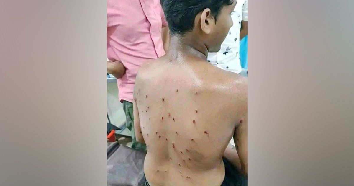 কুমিল্লায় মিছিলে ছাত্রলীগ-যুবলীগের গুলি, ১২ শিক্ষার্থী আহত