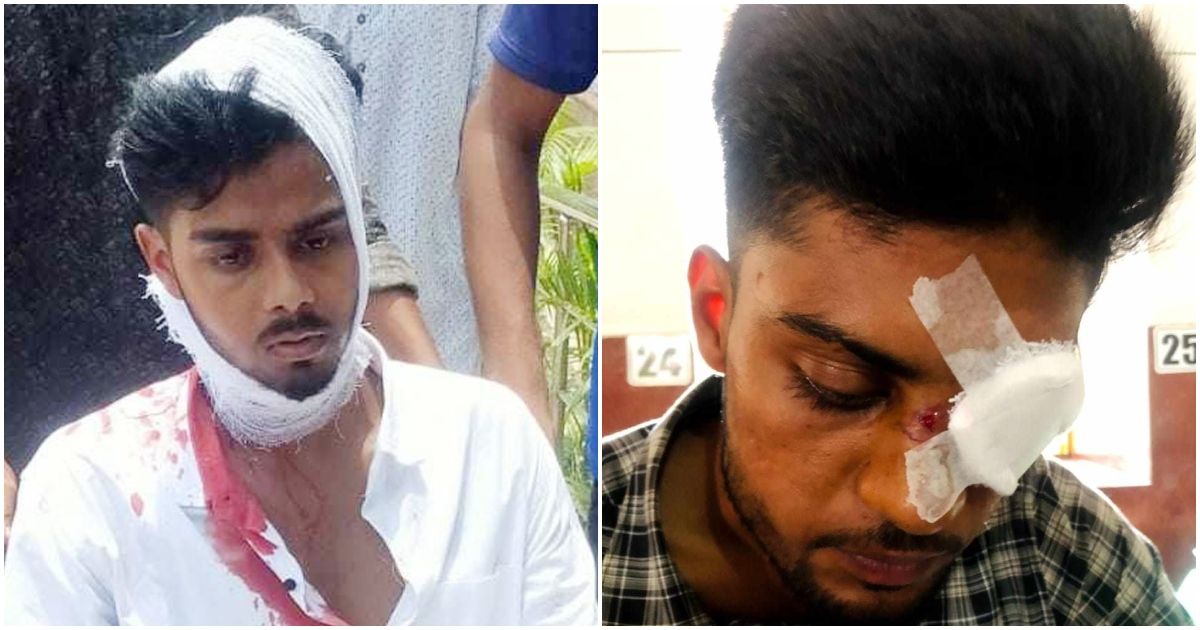 মির্জাপুরে-বৈষম্যবিরোধী-শিক্ষার্থীদের-ওপর-ছাত্রলীগের-হামলা-আহত-৩