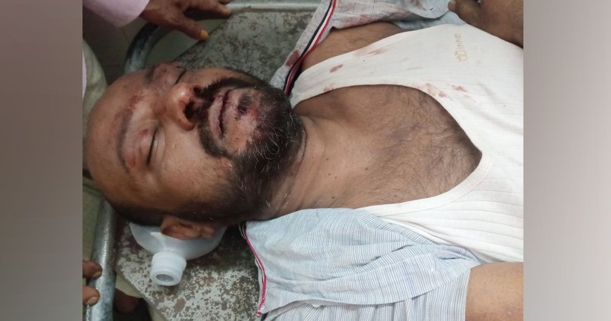 চট্টগ্রামে-ব্যবসায়ীর-ওপর-সন্ত্রাসীদের-হামলা-২০-লাখ-টাকা-লুট
